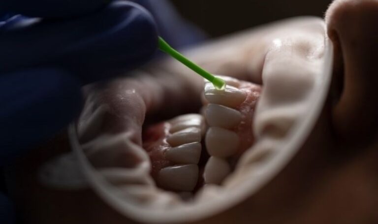 Kalıcı dişlerin yeniden çıkması mümkün olacak mı? – Son dakika bilim teknoloji haberleri